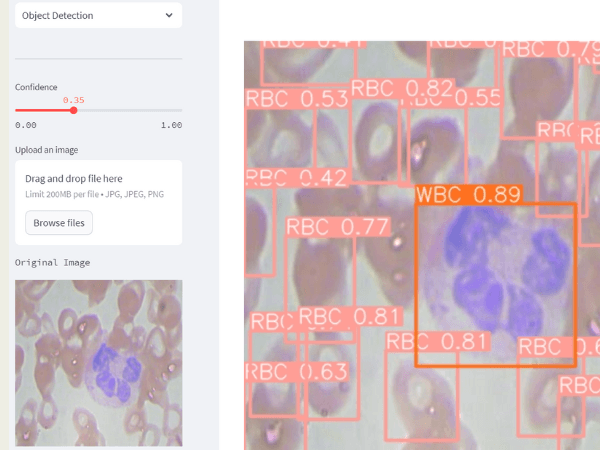 YOLOv8 Medical Imaging